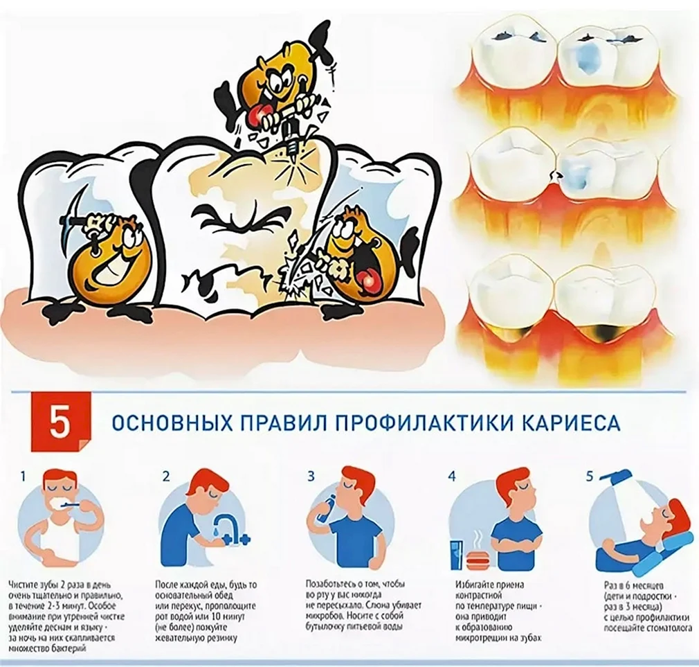 Можно лечить зубы на гв. 5 Основных правил профилактики кариеса.